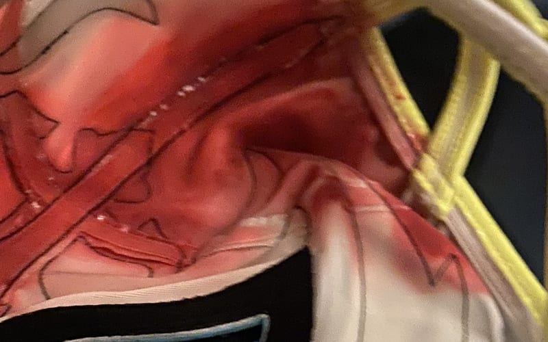 Rey Mysterio Shows Off Nasty Head Wound Following Retribution Attack On WWE RAW