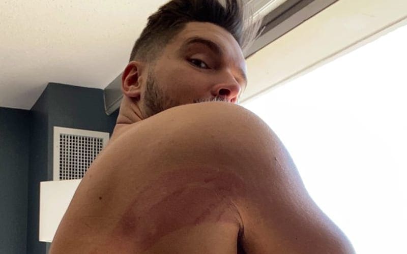 Ethan Page Thanks Cody Rhodes For Battle Marks After AEW Revolution Debut