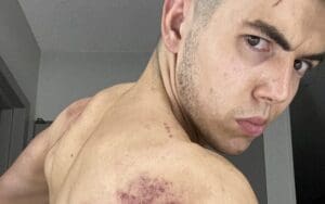 Sammy Guevara Shows Off Mangled Arm After AEW Blood & Guts Match