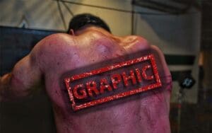 Drew McIntyre Shows Off Nasty Wounds After WWE Hell In A Cell