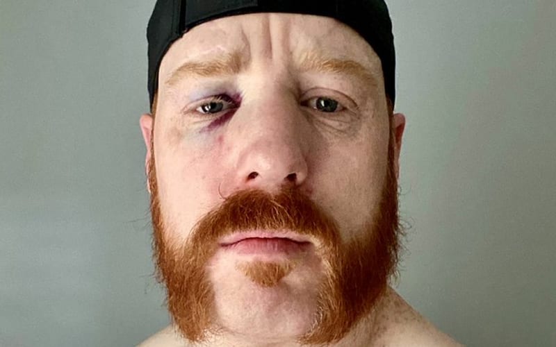 Sheamus Makes It Clear That He’s NOT Vacating US Title After Injury On WWE RAW