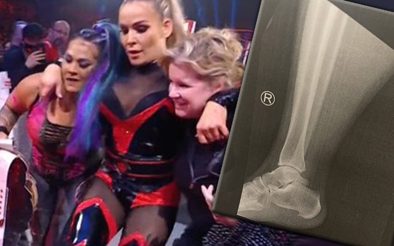 Natalya Shows Off X-Ray Of Recent Ankle Injury