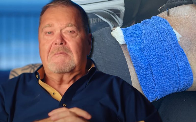 Jim Ross Confirms He Has Skin Cancer