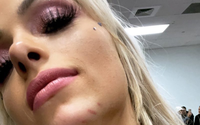 Liv Morgan Shows Off Battle Wounds On Her Chest After WWE Royal Rumble