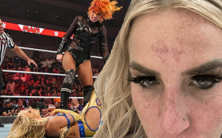 Dana Brooke Shows Nasty Bruises After Becky Lynch Stomped Her Face On WWE RAW