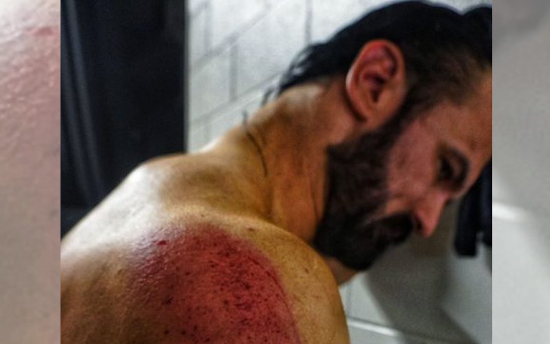 Drew McIntyre Shows Off Ridiculous Bruises After Brutal Attack On SmackDown