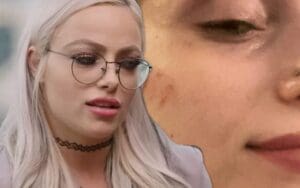 Liv Morgan Shows Off Nasty Bruises After Vicious Shayna Baszler Attack