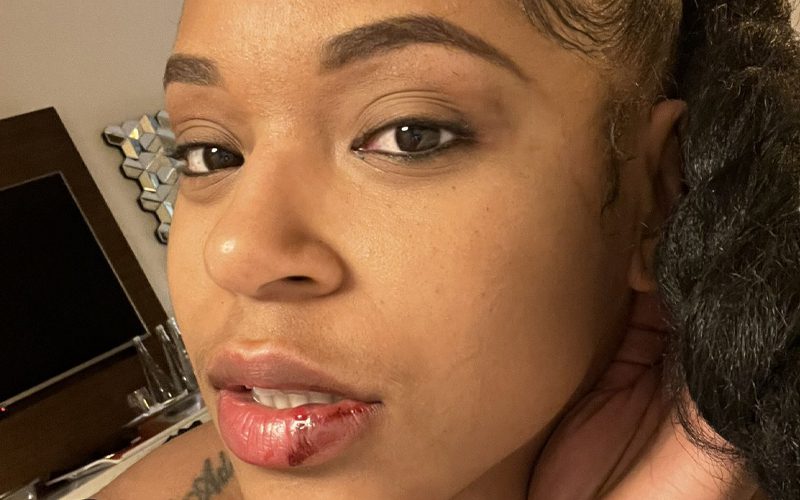 Bianca Belair Shows Off Nasty Wound After WWE RAW