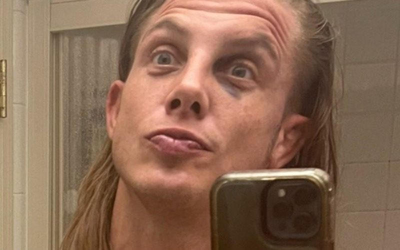 Matt Riddle Shows Off Abs & Black Eye In Mirror Selfie Drop