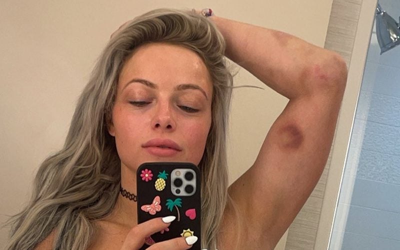 Liv Morgan Shows Off Nasty Battle Wounds From WWE SmackDown