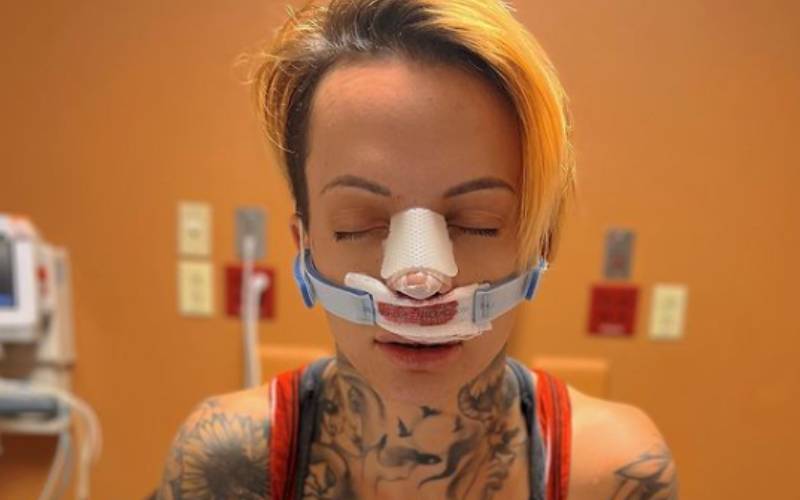 Ruby Soho Cannot Wait Until She Can ‘Breathe Again’ After Nose Surgery