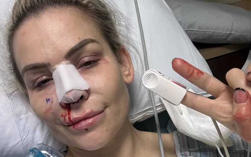 Natalya Says Doctors Had To Reset Her Nose After Bad Dislocation