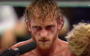 Logan Paul Will Be Out Of Action For At Least 6 Weeks