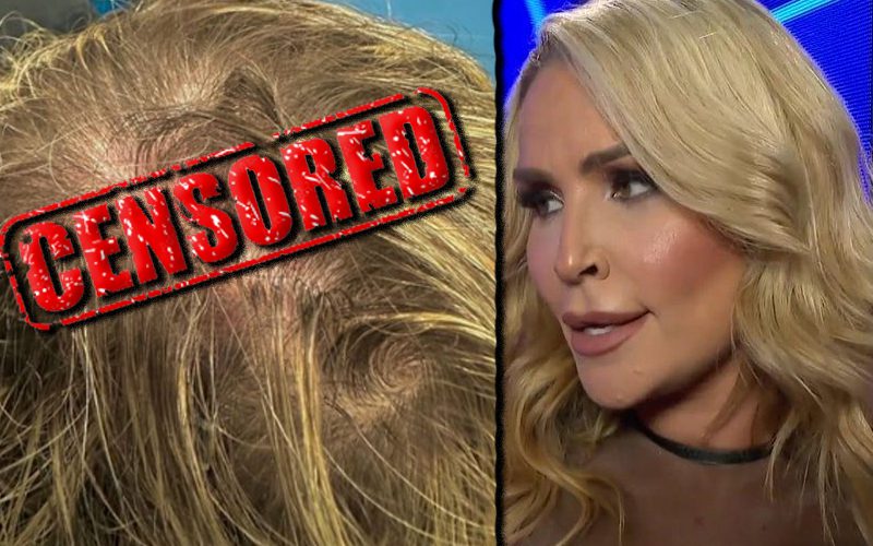 Natalya Shows Off Nasty Cut After Table Spot During WWE Live Event