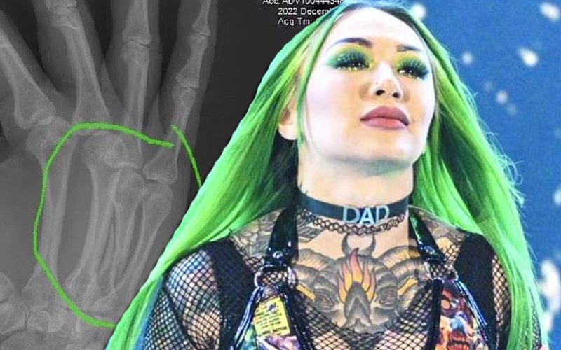 Shotzi Blackheart Shares X-Ray Of Injured Hand