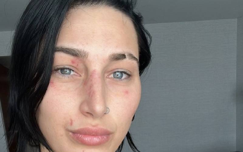Rhea Ripley Shows Off Her Battle Wounds The Day After 2023 WWE Royal Rumble