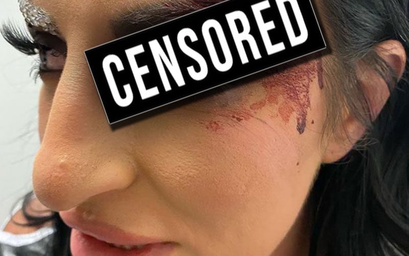 Sonya Deville Shows Off Nasty Cut After WWE Royal Rumble Match