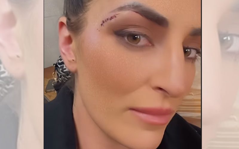 Sonya Deville Shows Nasty Cut From Recent WWE Live Event