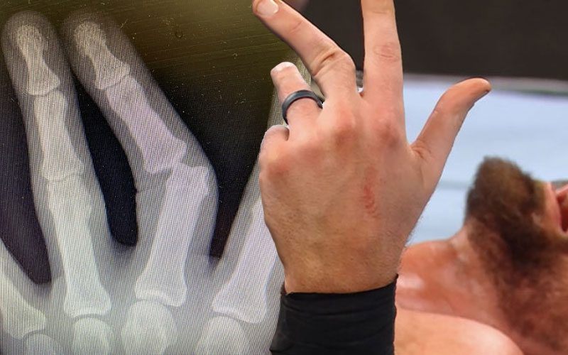 Dijak Shows X-Ray Of Brutal Dislocated Finger From WWE NXT Vengeance Day