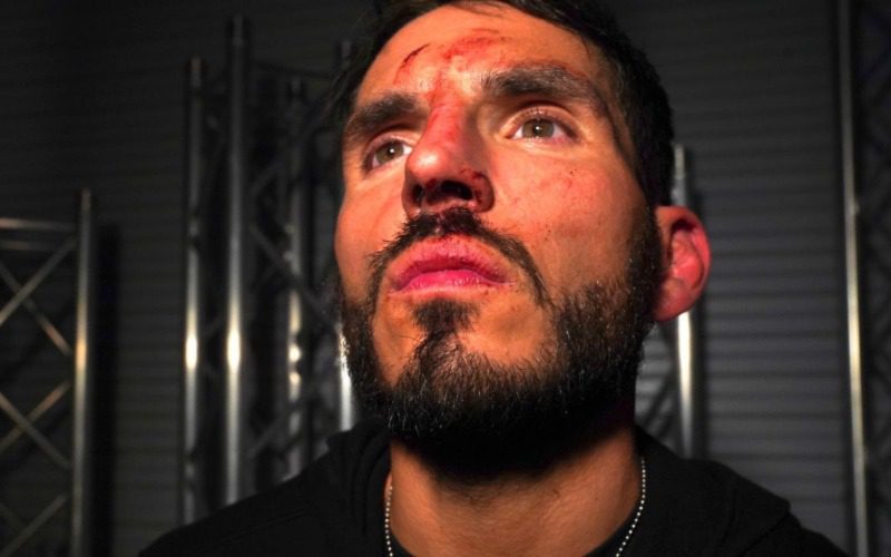Johnny Gargano Shows Bruises From Brawl With Grayson Waller On WWE NXT