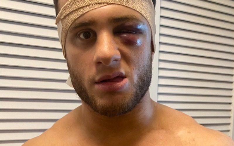 MJF Says Ring Rats Don’t Mind His Busted Face After AEW Revolution