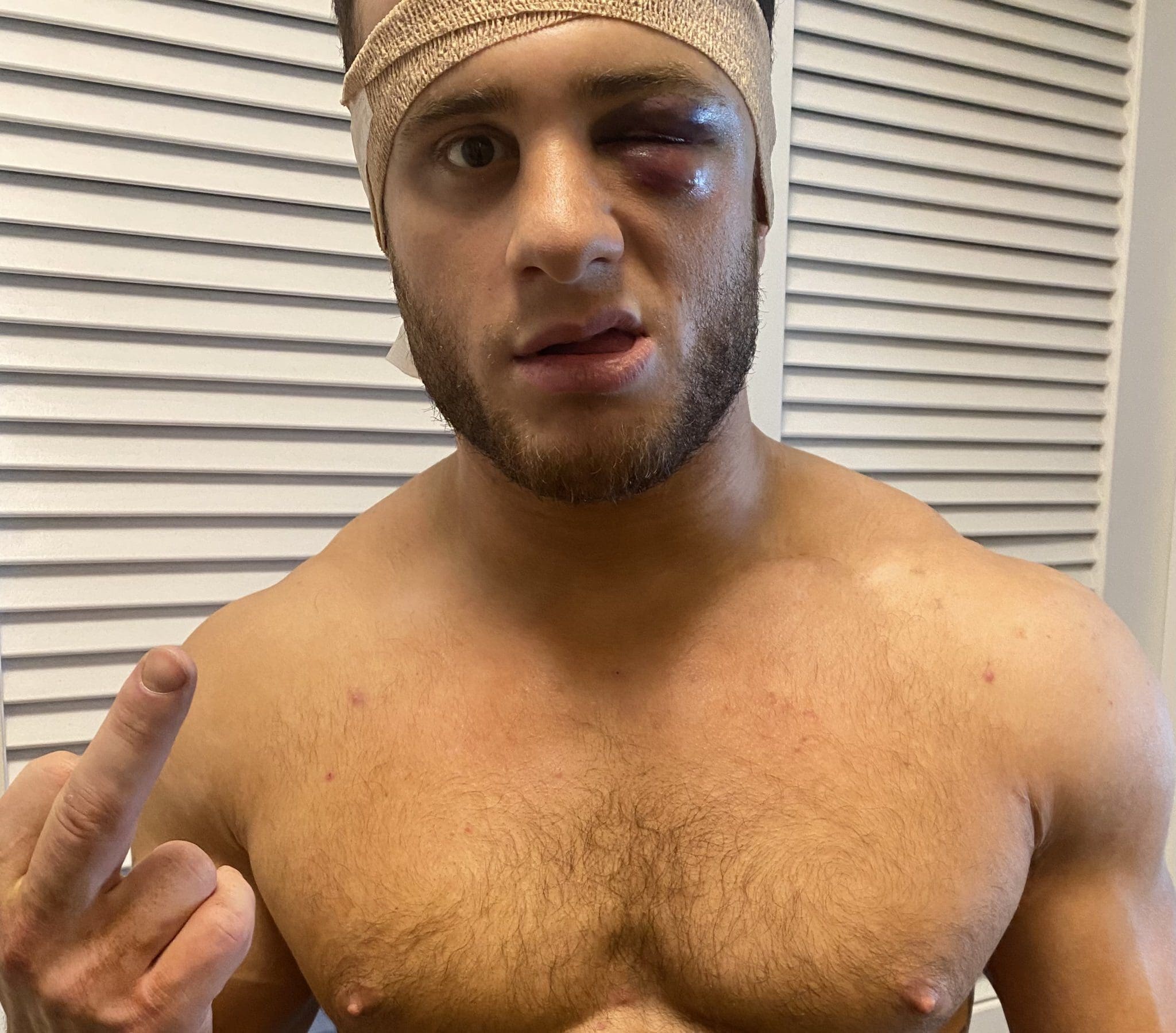 MJF Says Ring Rats Don’t Mind His Busted Face After AEW Revolution