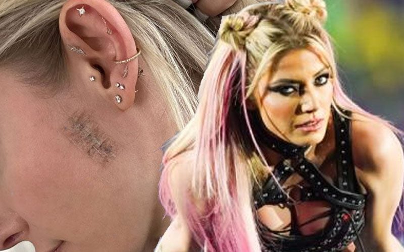 Alexa Bliss Shows Off Positive Recovery Progress After Skin Cancer Procedure
