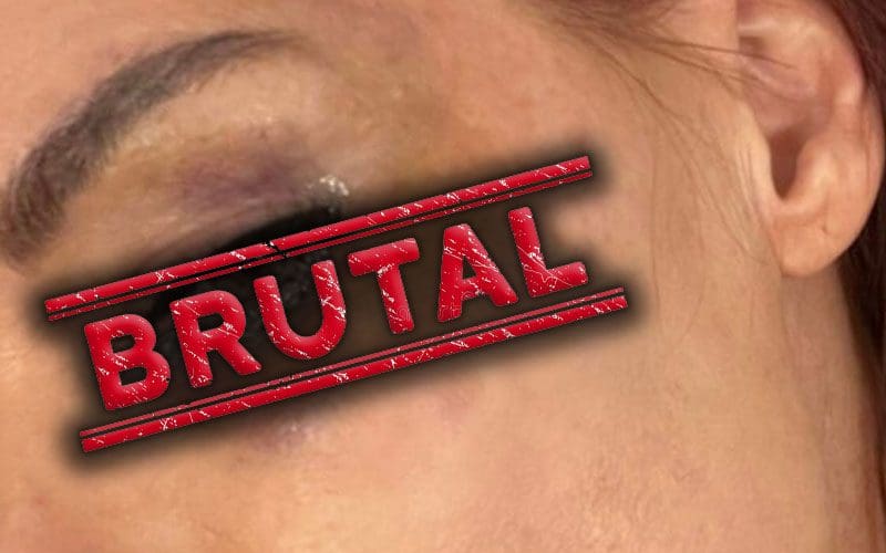 Lita Shows Off Brutal Black Eye After WrestleMania 39