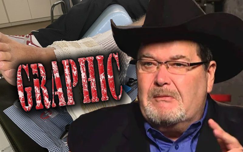 Jim Ross Says Wound From Skin Cancer Treatment Has Reduced By Over 50%
