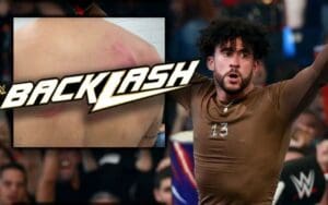 Bad Bunny Displays Gruesome Injuries After WWE Backlash