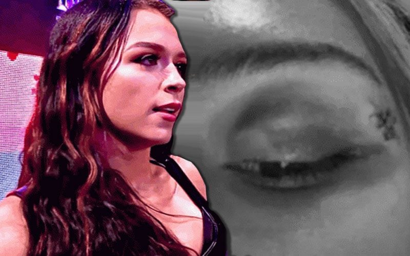 Cora Jade Shows Off Brutal Photo Of Damage After Her Last WWE NXT Match