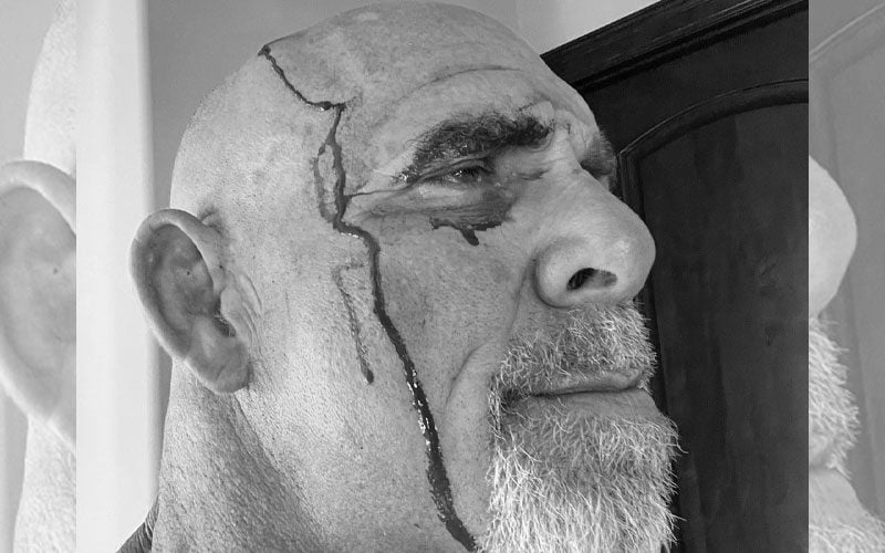 Goldberg Posts Bloody Photo After Suffering Injury At His Farm