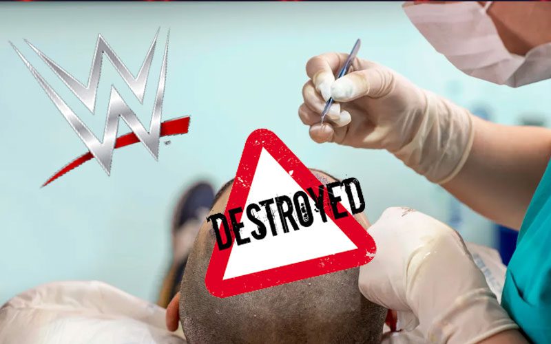 WWE Superstar’s Career Was Ruined By Hair Transplant Procedure