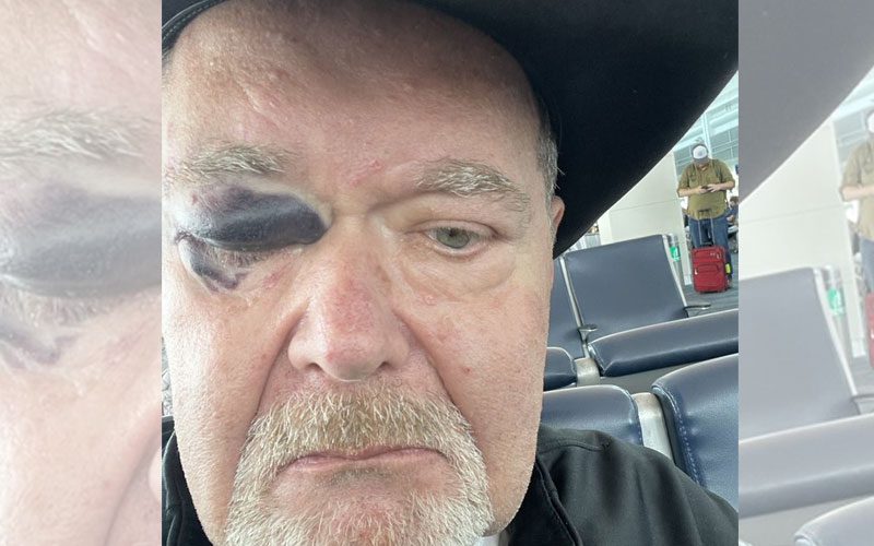 Jim Ross Posts Concerning Photo After Suffering Bad Fall
