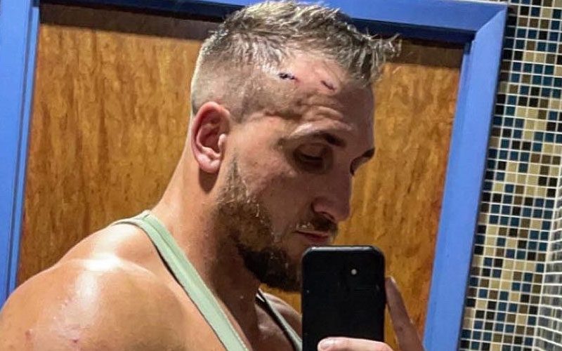 Preston Vance Shows Off Wounds After Brutal AEW Dynamite Match