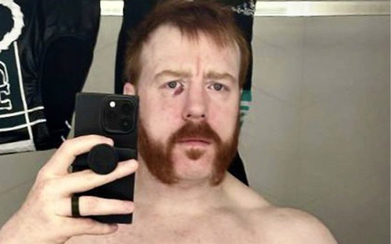 Sheamus Shows Off Nasty Battle Wounds After Recent WWE Live Event