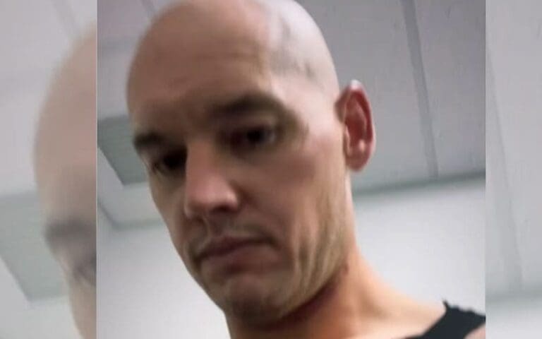 Baron Corbin Shows Off Crazy Neck Bruise After WWE NXT