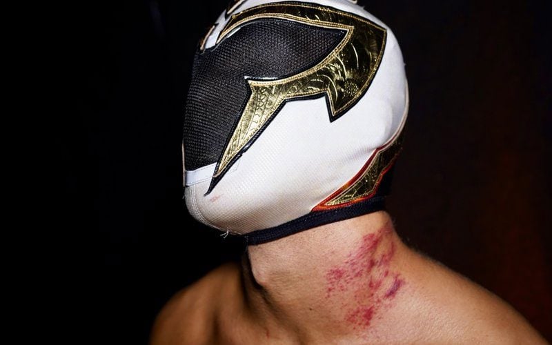 Axiom Shows Off Brutal Scar After WWE NXT Bout