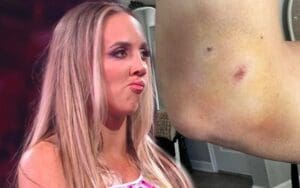 Chelsea Green Is Banged Up From Hematoma After Her Match On WWE RAW