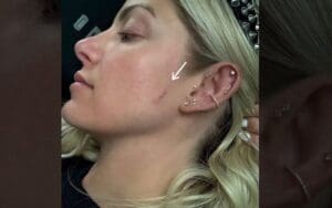Alexa Bliss Displays Scar from Skin Cancer Treatment