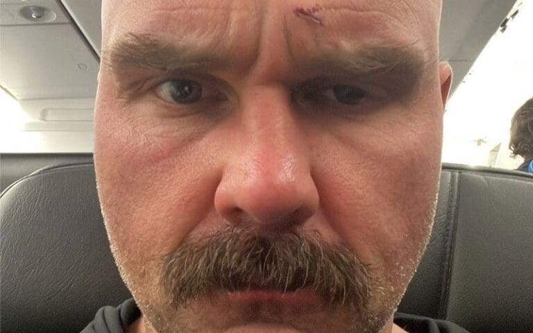 Dax Harwood Unveils Battle-Scarred Face Following Intense AEW Full Gear Showdown