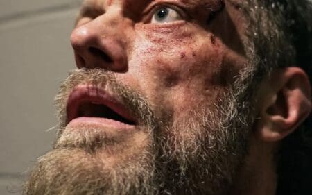 Adam Copeland Shows Off Nasty Battle Wounds After AEW Worlds End