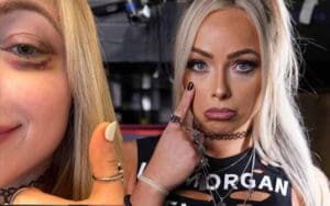 Liv Morgan Sports Black Eye After Competing in Battle Royal on RAW