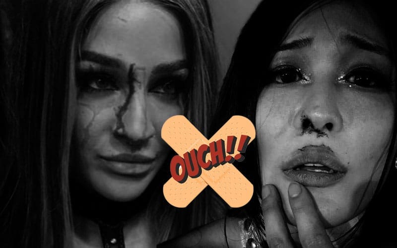 Iyo Sky and Dakota Kai’s Health Status After Bloody Wounds on 5/20 WWE RAW Revealed