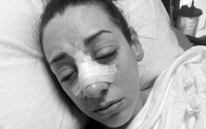 Jacy Jayne Drops Photo Post Surgery For Recent Nose Injury