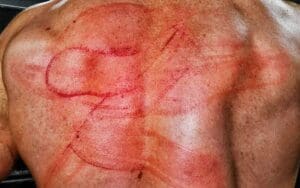 Drew McIntyre Shows Off Nasty Welts After CM Punk Assault on 8/12 WWE RAW