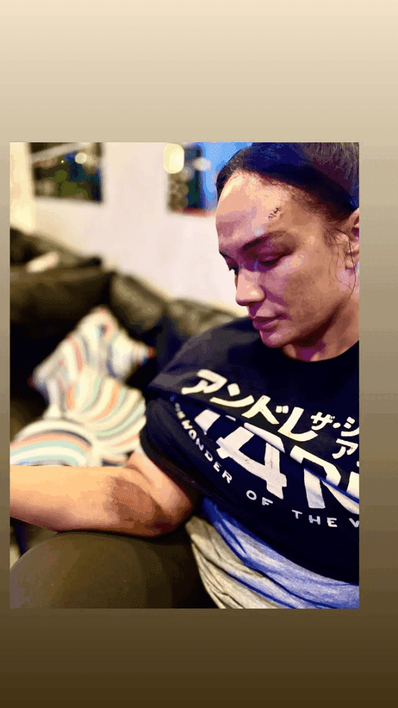 Nia Jax Received Stitches After Bloody Injury on 5/16 WWE SmackDown