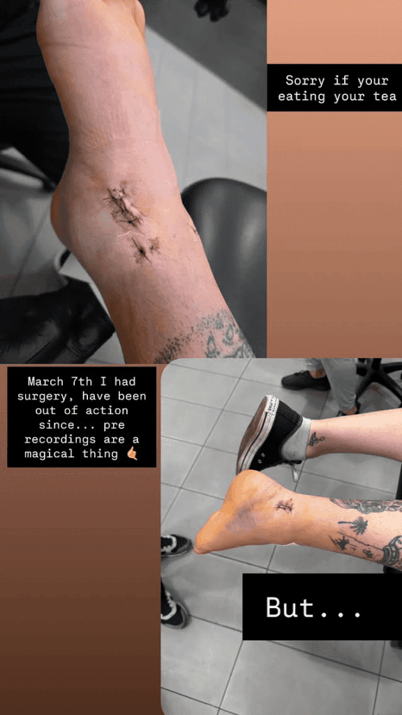 Riley Osborne Reveals WWE Released Him While Injured
