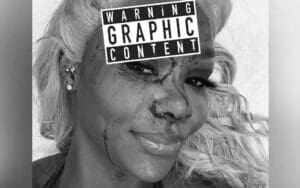 Jade Cargill Shows Off Graphic Bloody Cut After WWE SmackDown