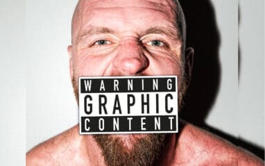 Jon Moxley Shows Off Nasty Chipped Tooth After AEW Worlds End